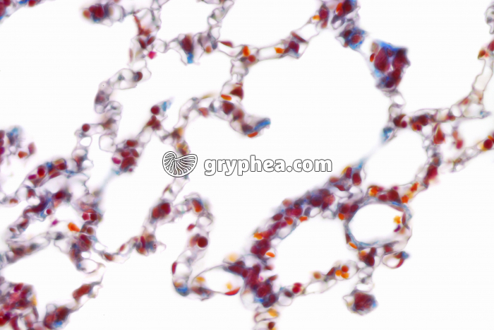 Poumon - CT montrant l'irrigation sanguine (capillaires sanguins) x160 - gryphea.org